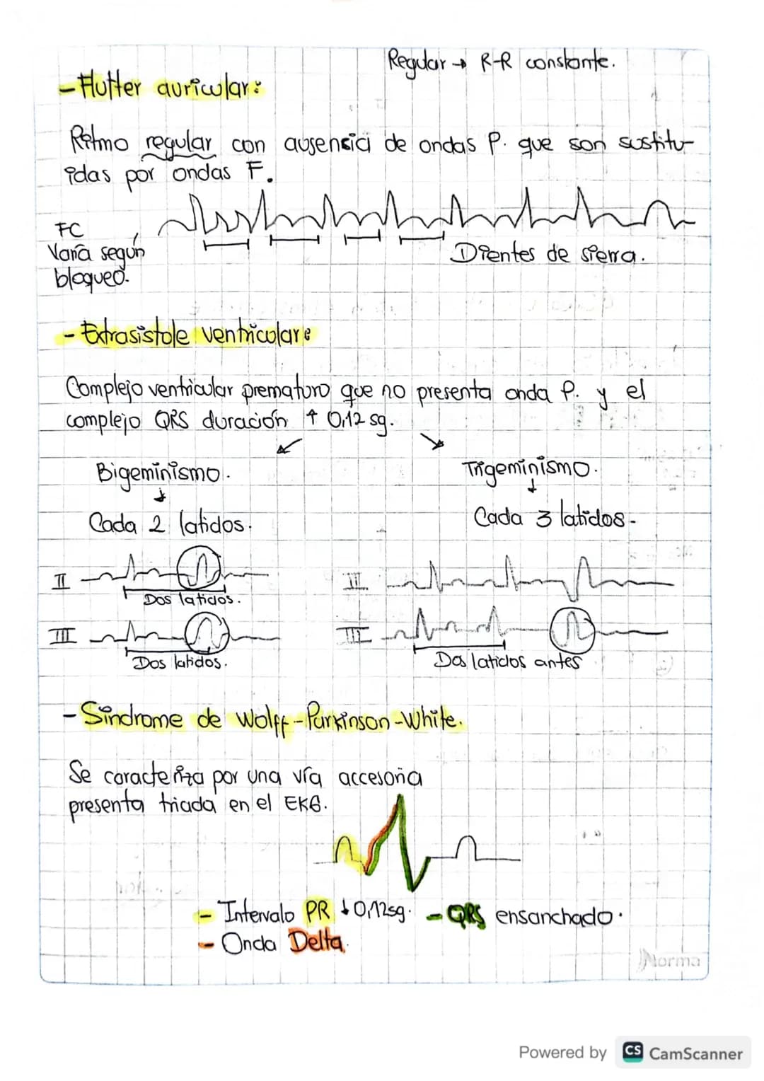 1. FC
• Paso a paso
• Como leer un electrocardiograma?
Contar de Ra R oantos cuadros hay.
20 pequeños la regla de 1500.
1500/20=751pm.
Valor