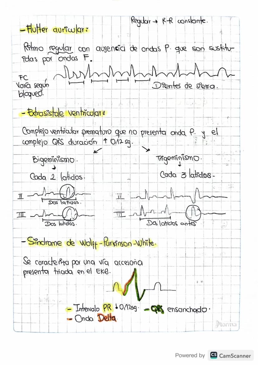 1. FC
• Paso a paso
• Como leer un electrocardiograma?
Contar de Ra R oantos cuadros hay.
20 pequeños la regla de 1500.
1500/20=751pm.
Valor
