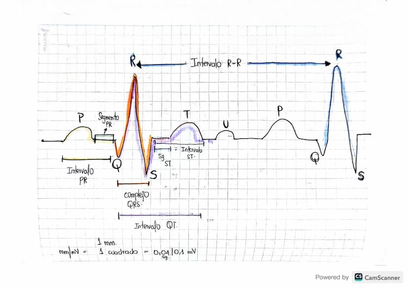 1. FC
• Paso a paso
• Como leer un electrocardiograma?
Contar de Ra R oantos cuadros hay.
20 pequeños la regla de 1500.
1500/20=751pm.
Valor