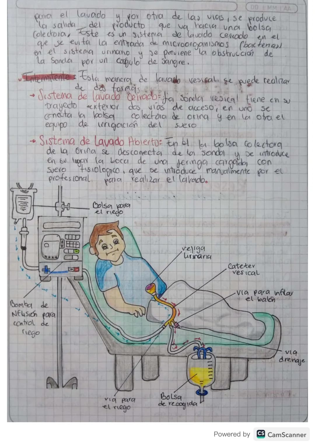 4
Cisto Irigación
LAVADO VESICAL
MTAA
Es una tecnica de tratamiento en la que se troduce
de en la veu del paciente, frecuentemente sue
sole,