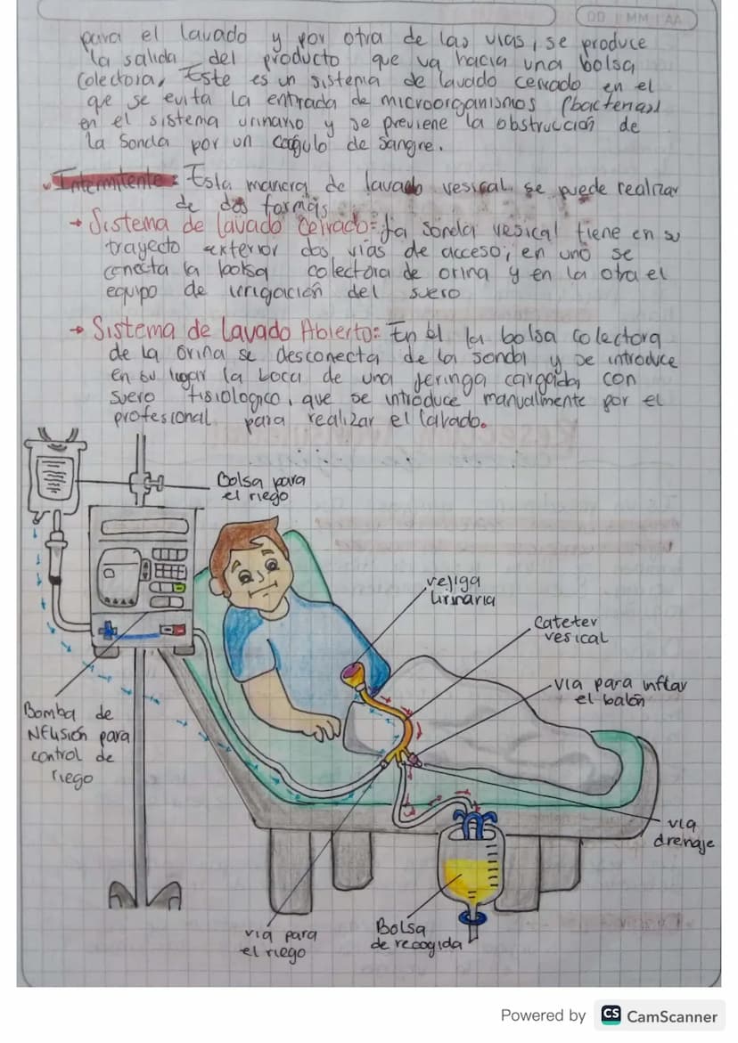 4
Cisto Irigación
LAVADO VESICAL
MTAA
Es una tecnica de tratamiento en la que se troduce
de en la veu del paciente, frecuentemente sue
sole,