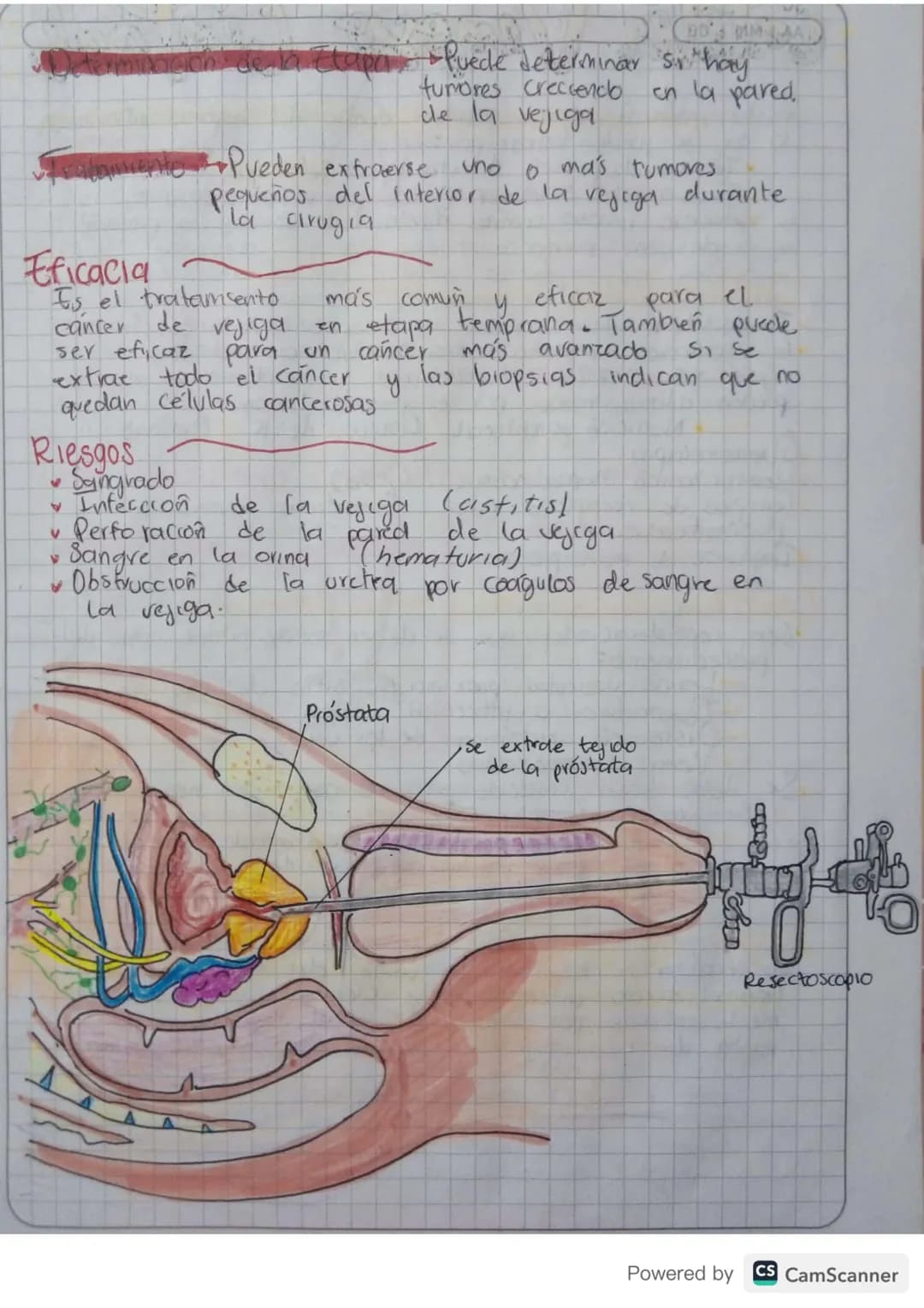 4
Cisto Irigación
LAVADO VESICAL
MTAA
Es una tecnica de tratamiento en la que se troduce
de en la veu del paciente, frecuentemente sue
sole,