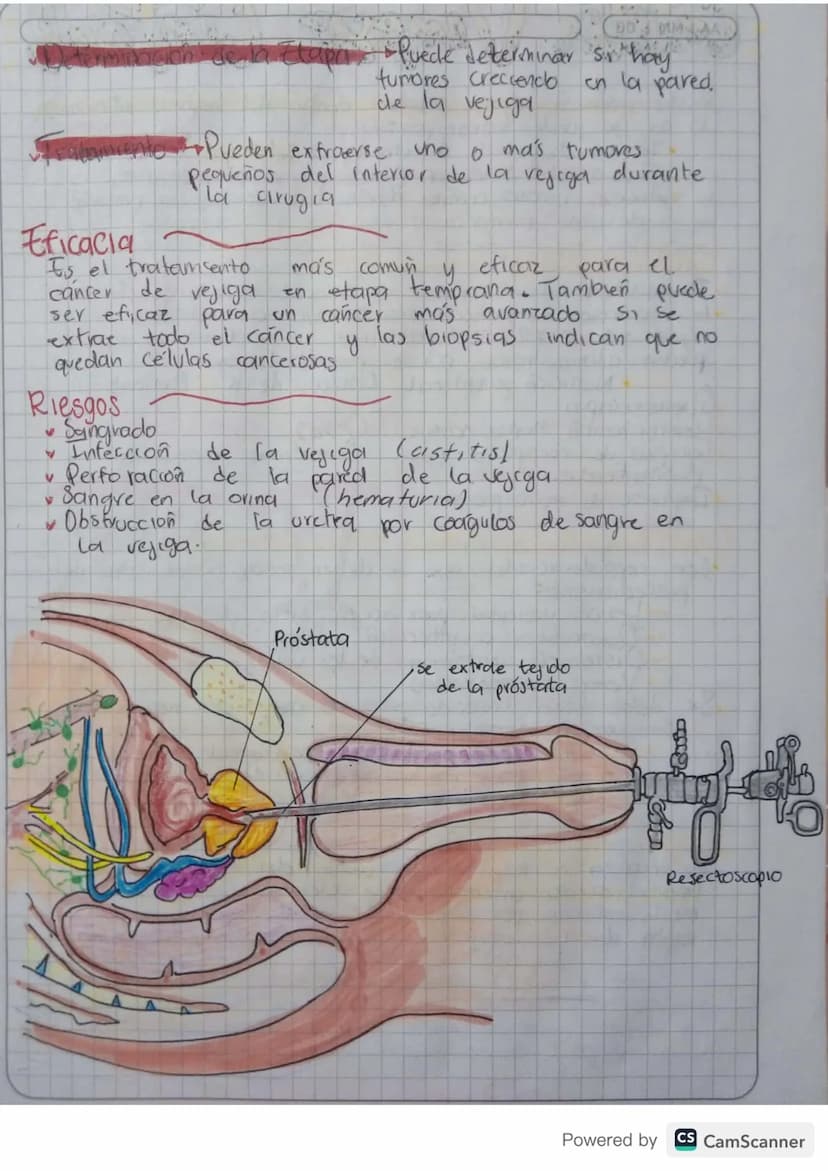4
Cisto Irigación
LAVADO VESICAL
MTAA
Es una tecnica de tratamiento en la que se troduce
de en la veu del paciente, frecuentemente sue
sole,