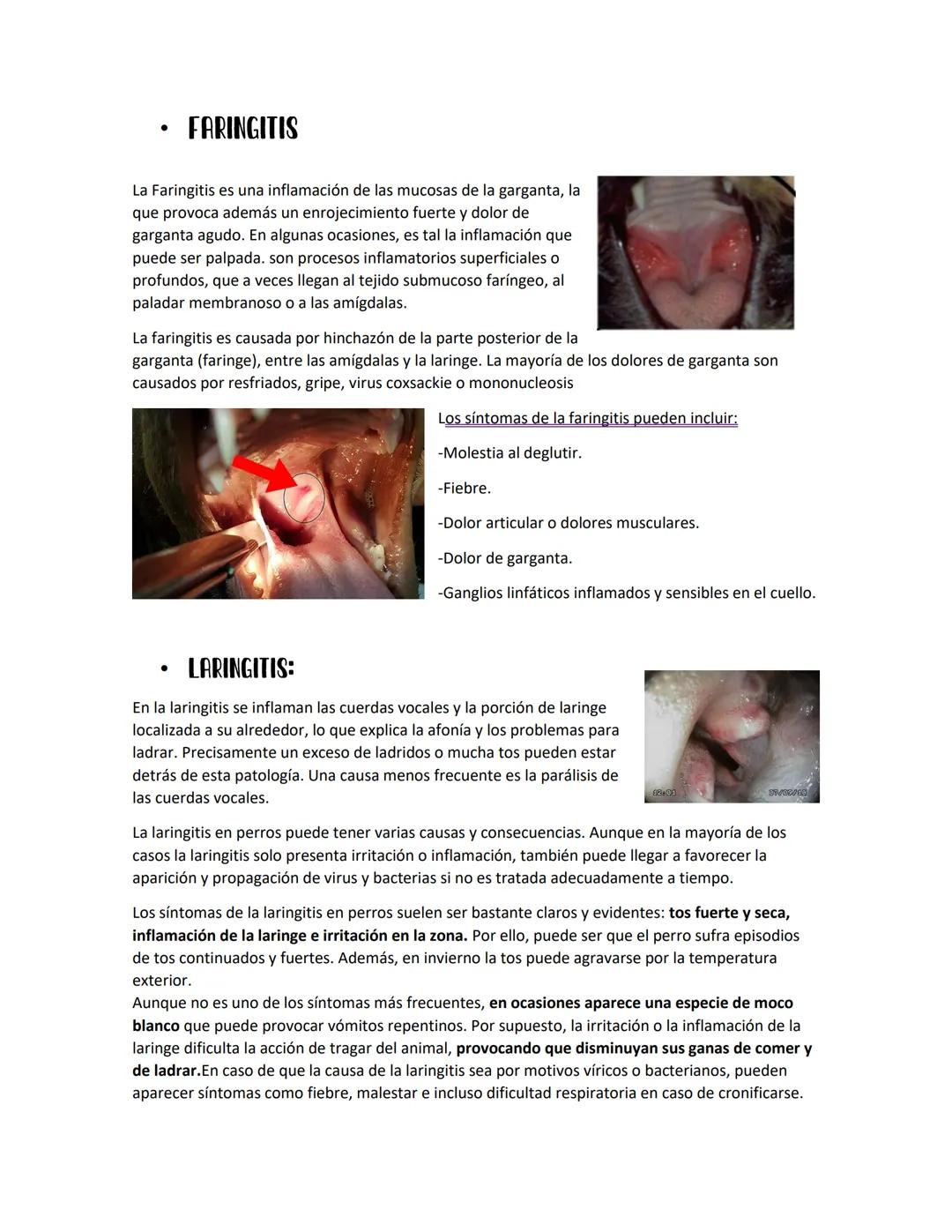 INFLAMACIONES DEL
Sistema nervioso
PLEURITIS:
La pleuritis es hinchazón (inflamación) de las capas delgadas de tejido
(pleura) que recubren 