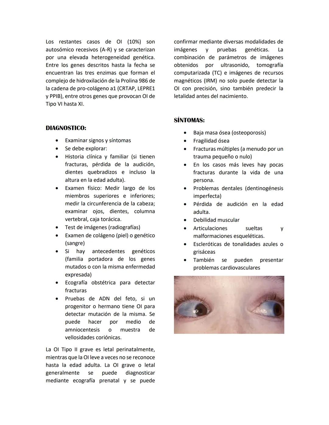 OSTEOGENESIS IMPERFECTA
Se encuentra dentro del gran grupo de las colagenopatías: Estos desordenes incluyen anomalías en
la estructura o can
