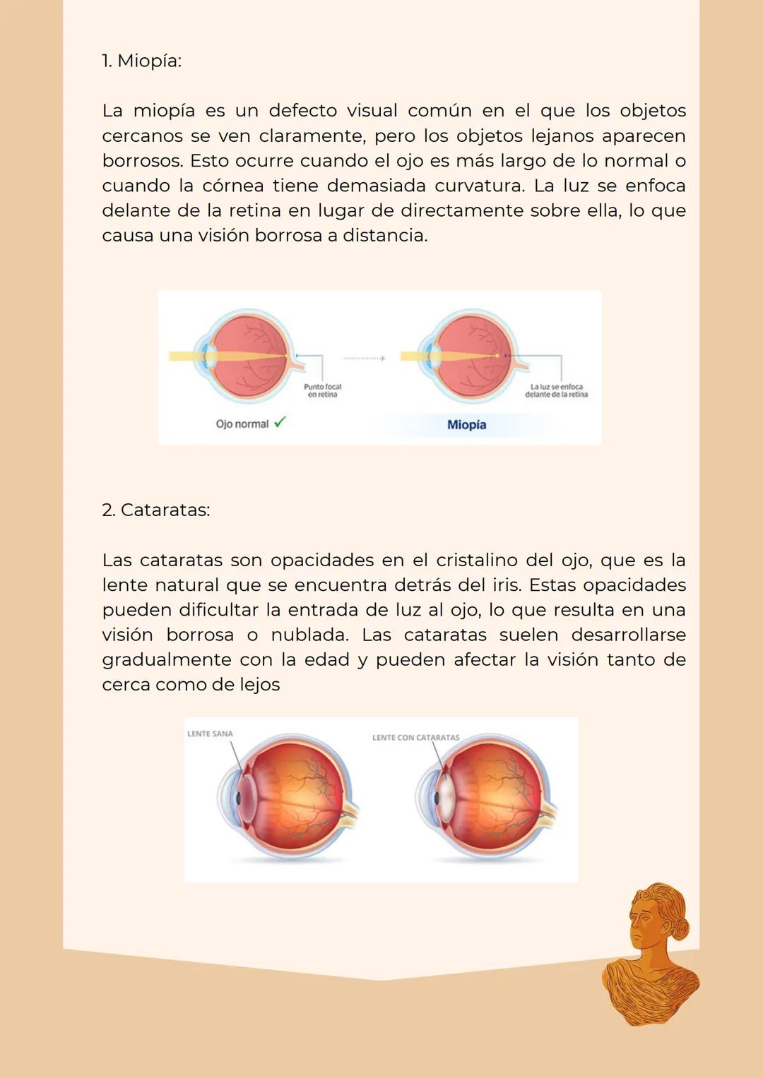 # IENTES
. Investiga y realiza las gráficas de los principales rayos notables
en cada una de los lentes
Los principales rayos notables en