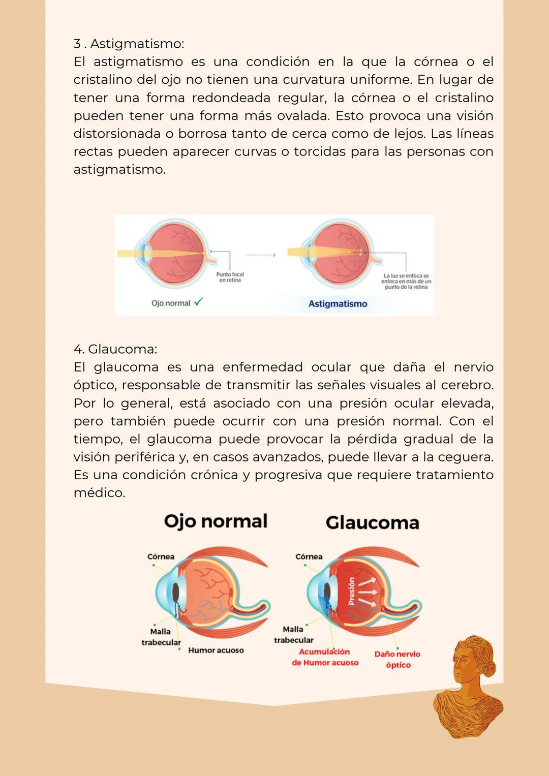 # IENTES
. Investiga y realiza las gráficas de los principales rayos notables
en cada una de los lentes
Los principales rayos notables en