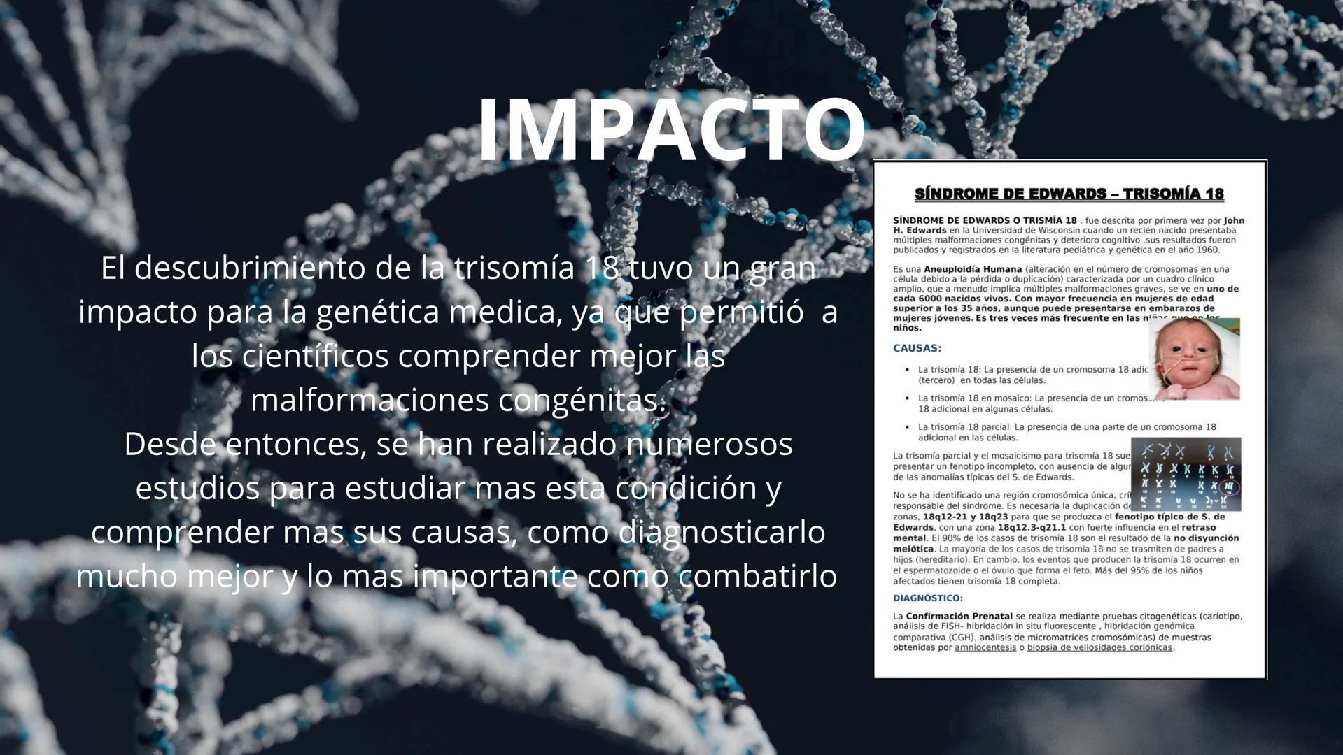 SÍNDROME
DE
EDWARDS
David Alejandro Rojas Luján
David Santiago García Herrera
Axel Mateo Zapata Oquendo ¿Que es el "síndrome de Edwards"?