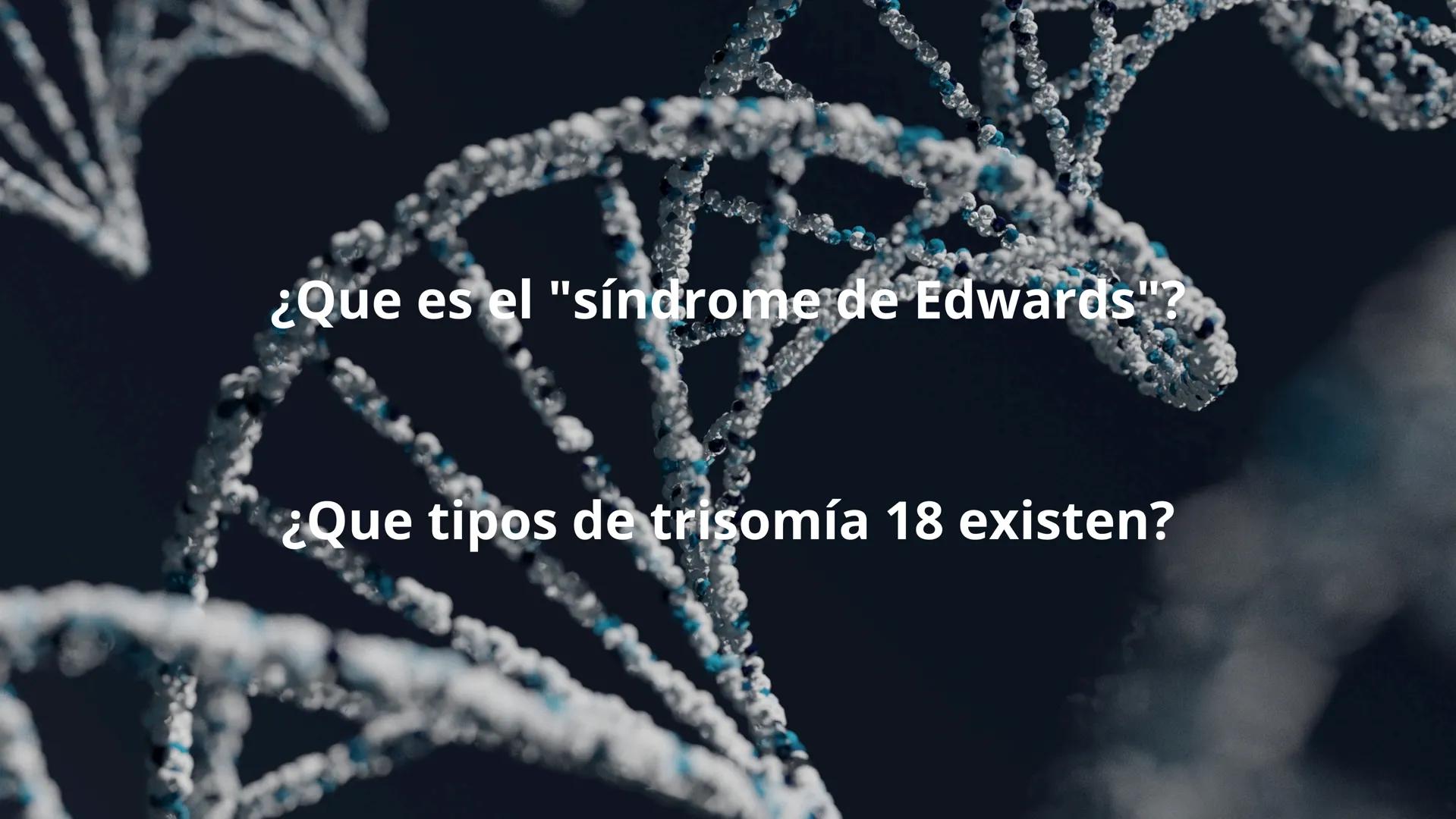 SÍNDROME
DE
EDWARDS
David Alejandro Rojas Luján
David Santiago García Herrera
Axel Mateo Zapata Oquendo ¿Que es el "síndrome de Edwards"?