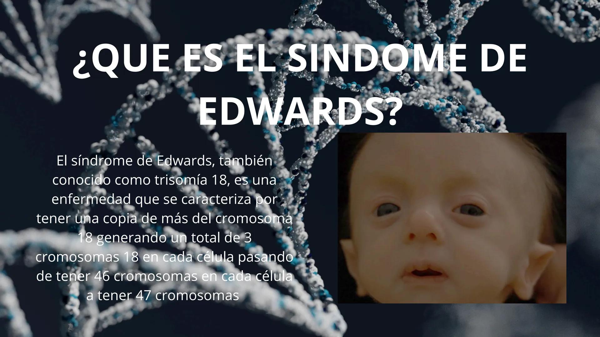 SÍNDROME
DE
EDWARDS
David Alejandro Rojas Luján
David Santiago García Herrera
Axel Mateo Zapata Oquendo ¿Que es el "síndrome de Edwards"?