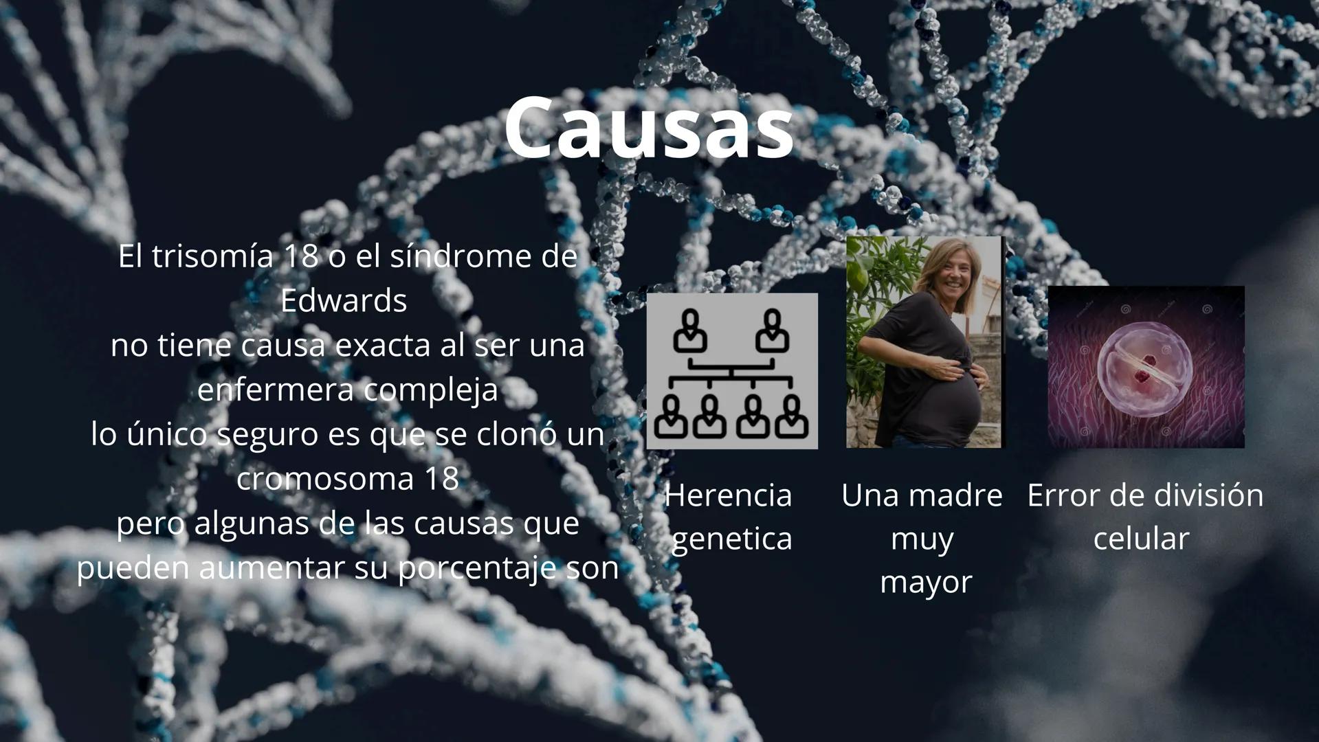 SÍNDROME
DE
EDWARDS
David Alejandro Rojas Luján
David Santiago García Herrera
Axel Mateo Zapata Oquendo ¿Que es el "síndrome de Edwards"?