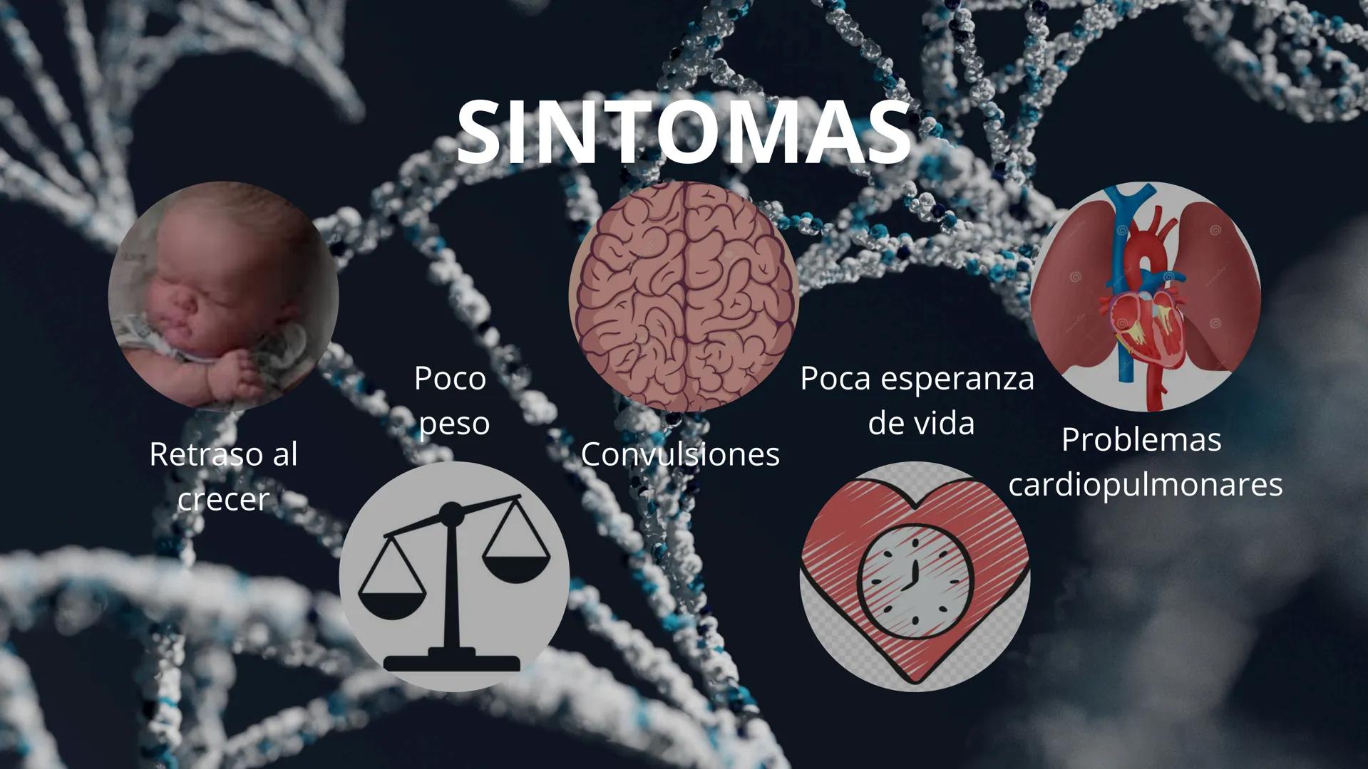 SÍNDROME
DE
EDWARDS
David Alejandro Rojas Luján
David Santiago García Herrera
Axel Mateo Zapata Oquendo ¿Que es el "síndrome de Edwards"?