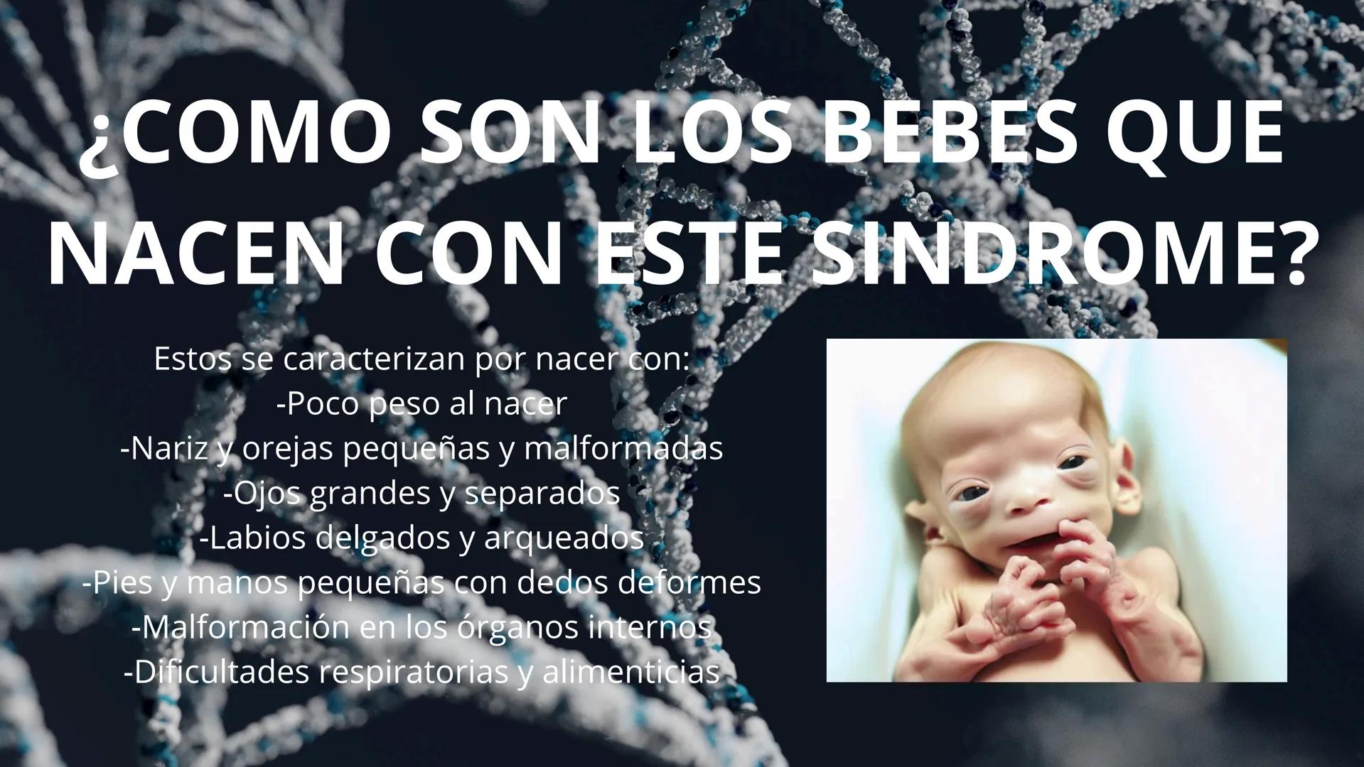 SÍNDROME
DE
EDWARDS
David Alejandro Rojas Luján
David Santiago García Herrera
Axel Mateo Zapata Oquendo ¿Que es el "síndrome de Edwards"?