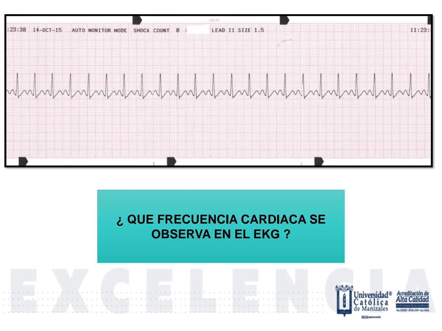 UCM
DAD 1954
UNIVERSIDAD
CARIDAD
CATOLICA
UniversidadⓇ
Católica
de Manizales
VIGILADA MINEDUCACIÓN
Acreditación de
Alta Calidad
en el camino