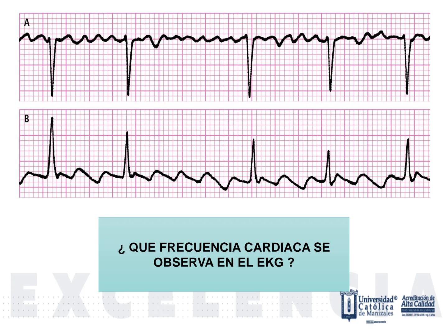 UCM
DAD 1954
UNIVERSIDAD
CARIDAD
CATOLICA
UniversidadⓇ
Católica
de Manizales
VIGILADA MINEDUCACIÓN
Acreditación de
Alta Calidad
en el camino