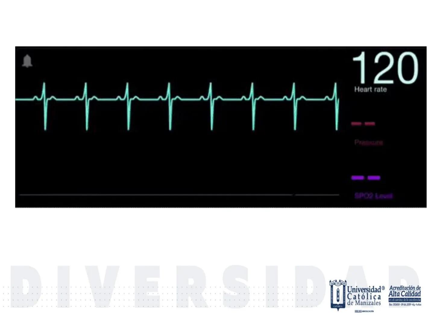 UCM
DAD 1954
UNIVERSIDAD
CARIDAD
CATOLICA
UniversidadⓇ
Católica
de Manizales
VIGILADA MINEDUCACIÓN
Acreditación de
Alta Calidad
en el camino