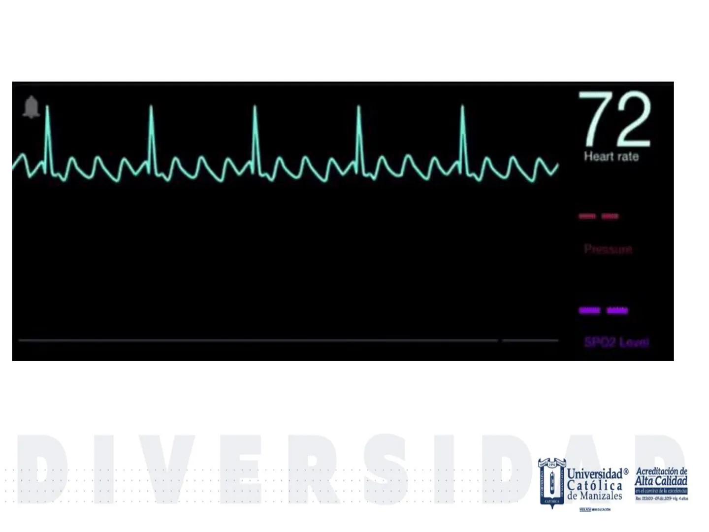 UCM
DAD 1954
UNIVERSIDAD
CARIDAD
CATOLICA
UniversidadⓇ
Católica
de Manizales
VIGILADA MINEDUCACIÓN
Acreditación de
Alta Calidad
en el camino