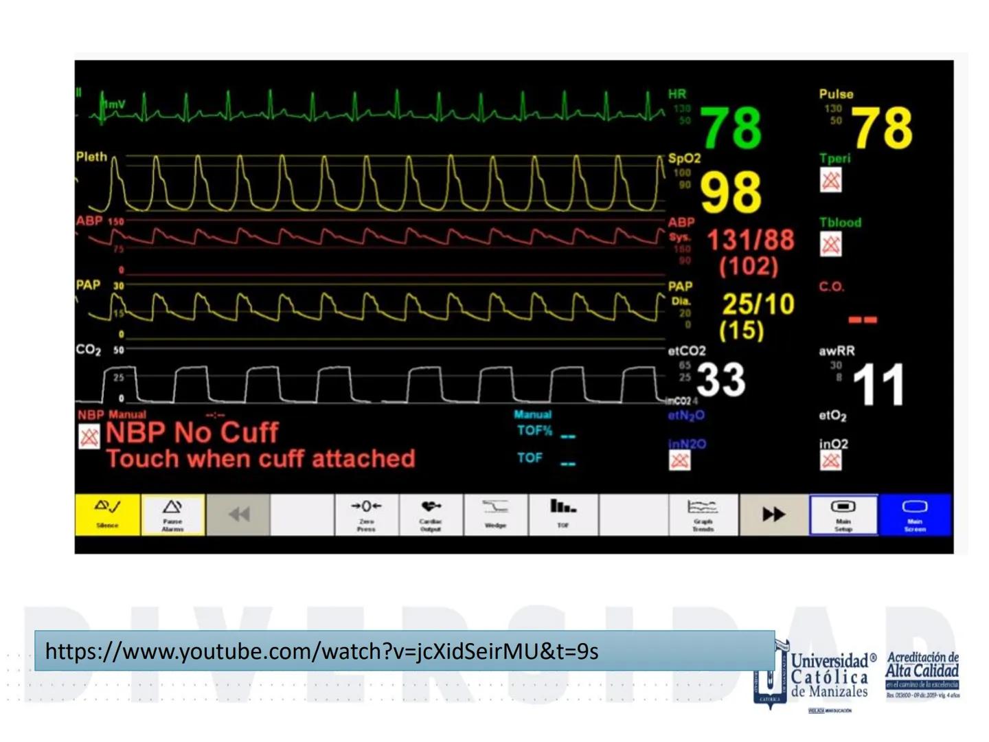 UCM
DAD 1954
UNIVERSIDAD
CARIDAD
CATOLICA
UniversidadⓇ
Católica
de Manizales
VIGILADA MINEDUCACIÓN
Acreditación de
Alta Calidad
en el camino