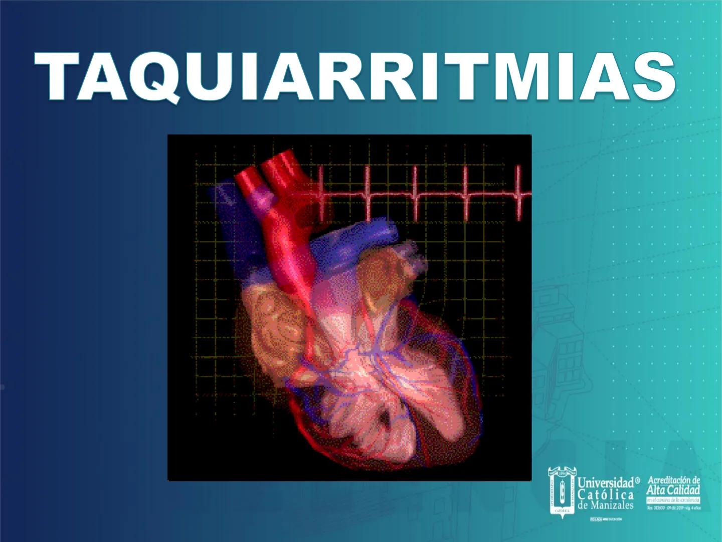 UCM
DAD 1954
UNIVERSIDAD
CARIDAD
CATOLICA
UniversidadⓇ
Católica
de Manizales
VIGILADA MINEDUCACIÓN
Acreditación de
Alta Calidad
en el camino