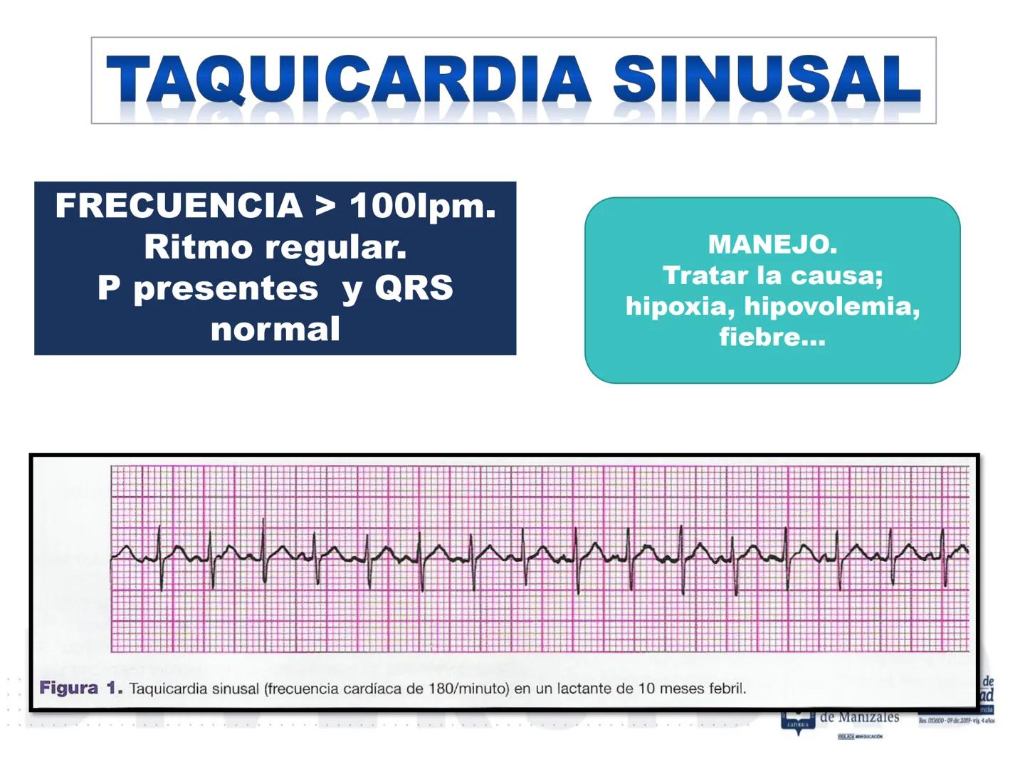 UCM
DAD 1954
UNIVERSIDAD
CARIDAD
CATOLICA
UniversidadⓇ
Católica
de Manizales
VIGILADA MINEDUCACIÓN
Acreditación de
Alta Calidad
en el camino