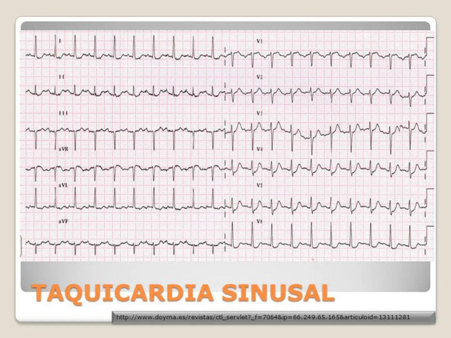 UCM
DAD 1954
UNIVERSIDAD
CARIDAD
CATOLICA
UniversidadⓇ
Católica
de Manizales
VIGILADA MINEDUCACIÓN
Acreditación de
Alta Calidad
en el camino
