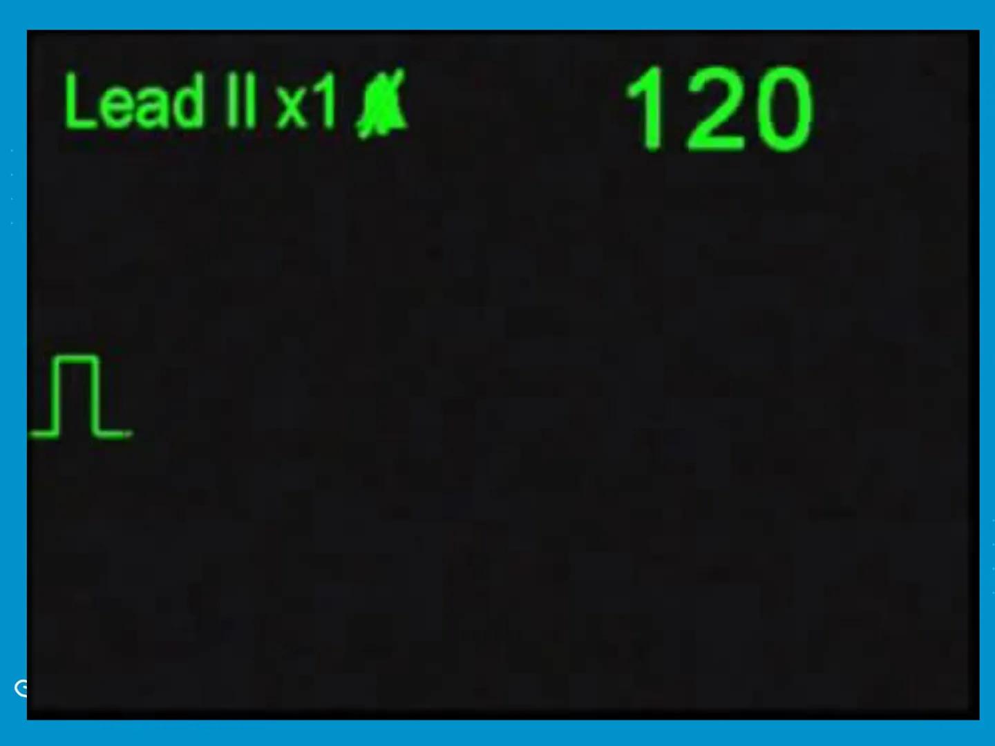 UCM
DAD 1954
UNIVERSIDAD
CARIDAD
CATOLICA
UniversidadⓇ
Católica
de Manizales
VIGILADA MINEDUCACIÓN
Acreditación de
Alta Calidad
en el camino