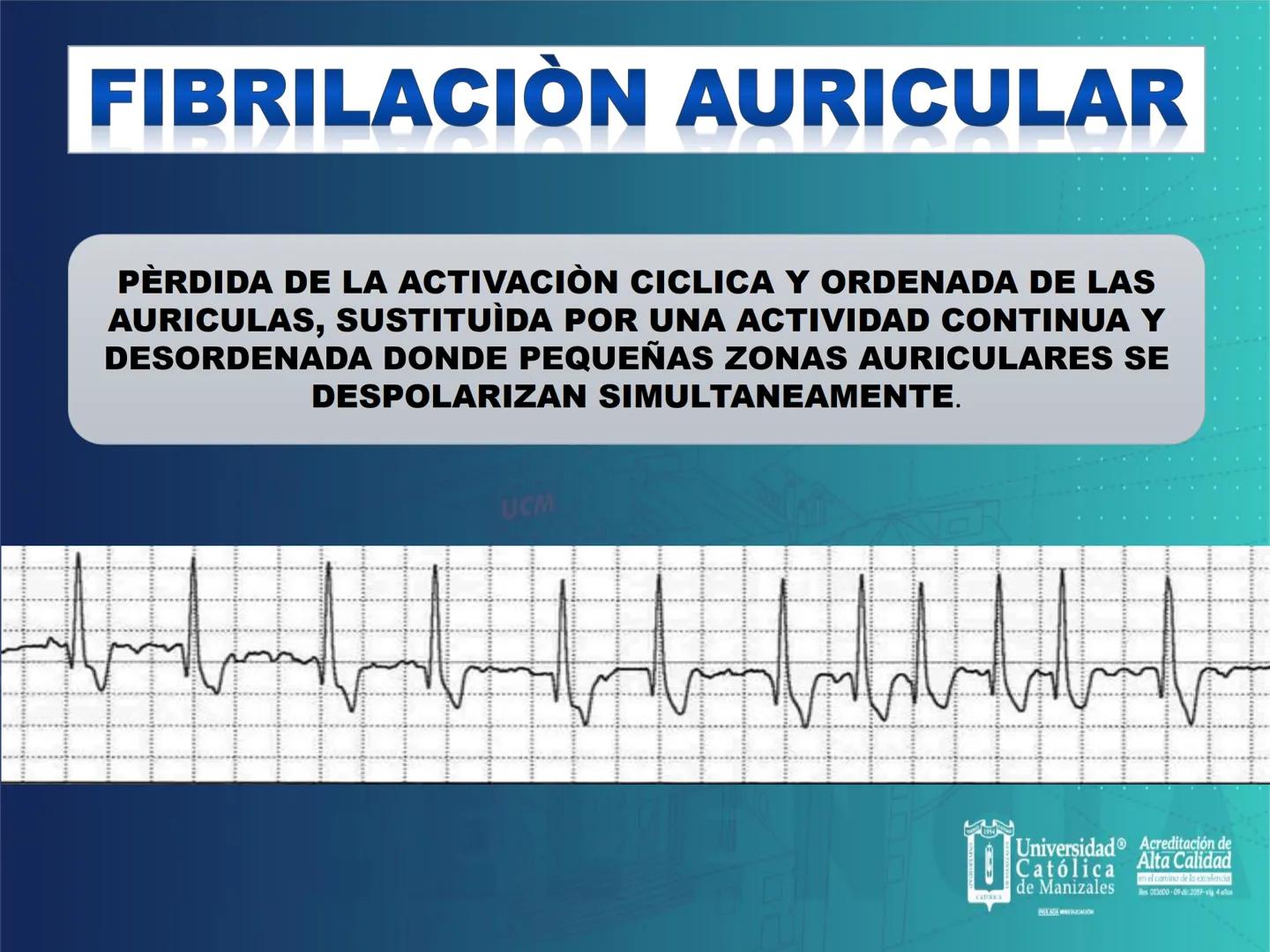 UCM
DAD 1954
UNIVERSIDAD
CARIDAD
CATOLICA
UniversidadⓇ
Católica
de Manizales
VIGILADA MINEDUCACIÓN
Acreditación de
Alta Calidad
en el camino
