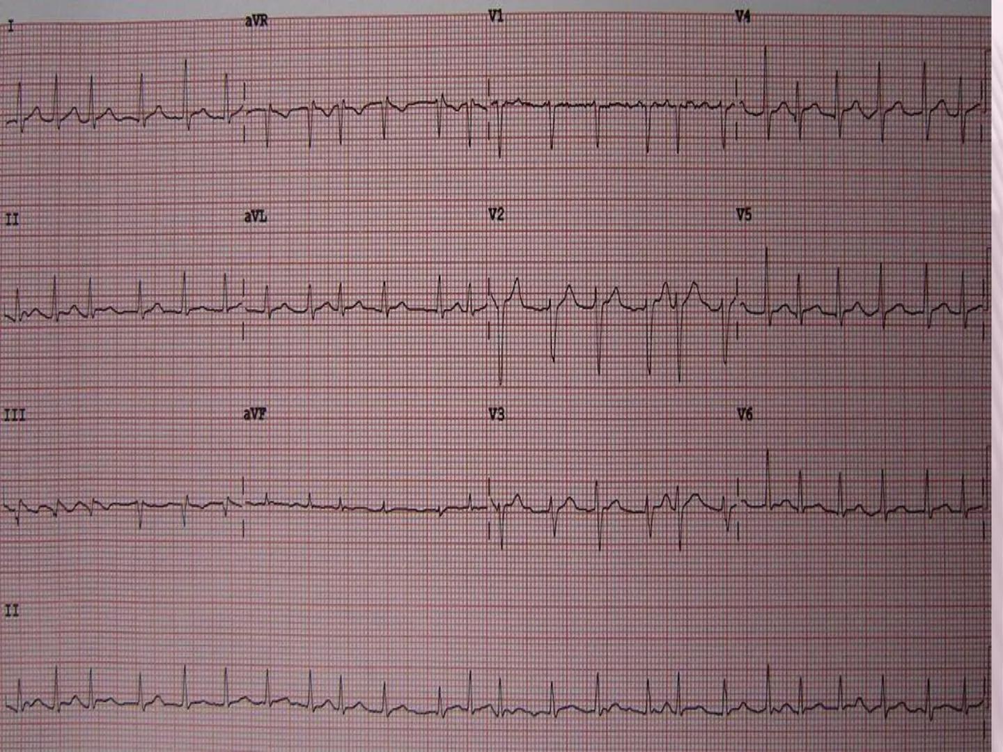 UCM
DAD 1954
UNIVERSIDAD
CARIDAD
CATOLICA
UniversidadⓇ
Católica
de Manizales
VIGILADA MINEDUCACIÓN
Acreditación de
Alta Calidad
en el camino