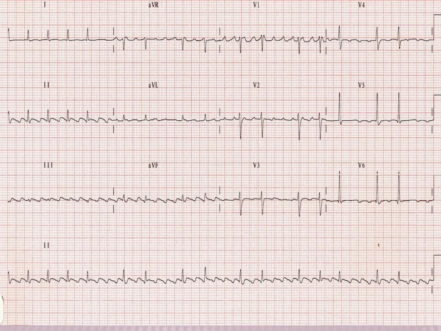 UCM
DAD 1954
UNIVERSIDAD
CARIDAD
CATOLICA
UniversidadⓇ
Católica
de Manizales
VIGILADA MINEDUCACIÓN
Acreditación de
Alta Calidad
en el camino