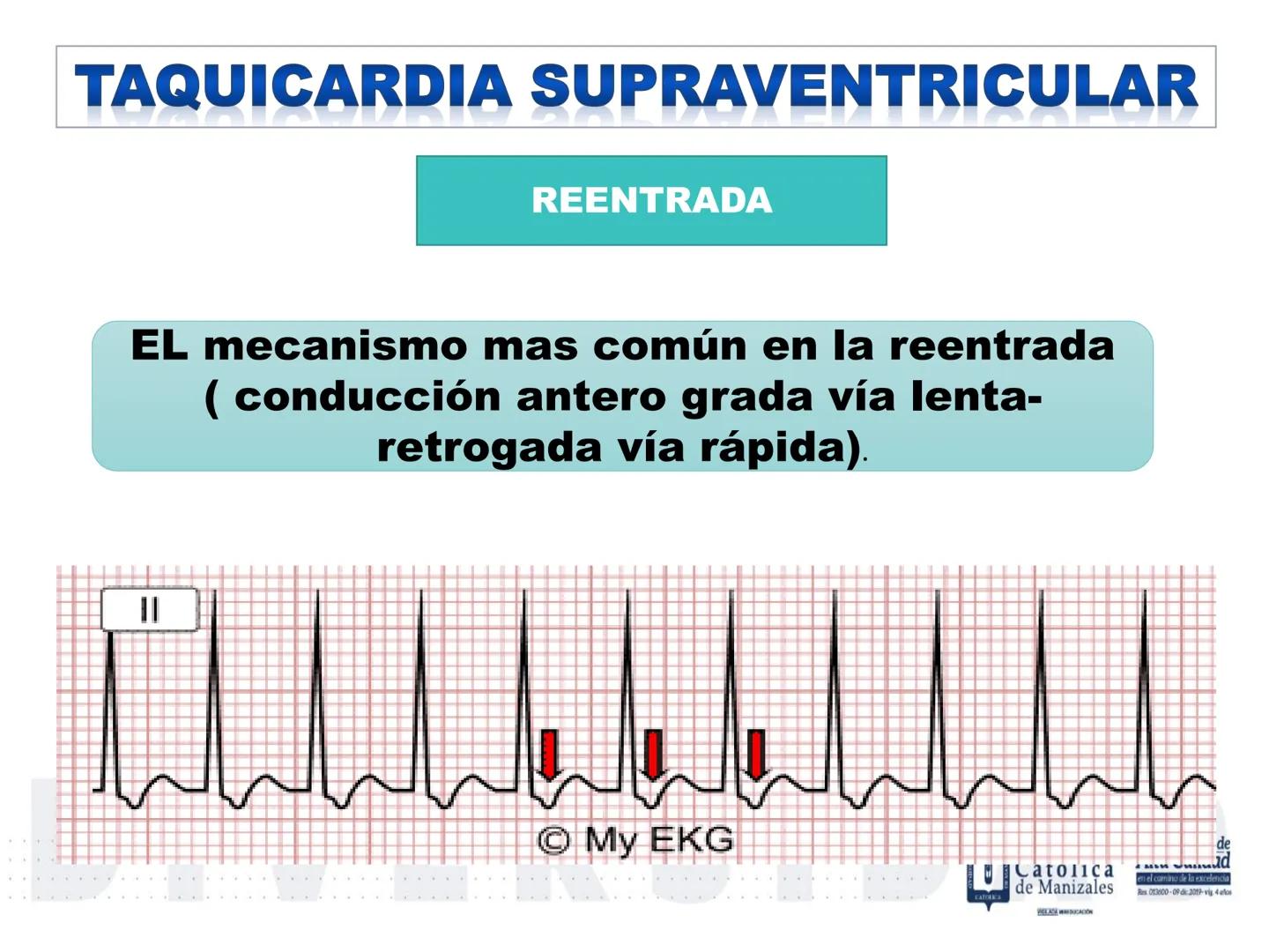 UCM
DAD 1954
UNIVERSIDAD
CARIDAD
CATOLICA
UniversidadⓇ
Católica
de Manizales
VIGILADA MINEDUCACIÓN
Acreditación de
Alta Calidad
en el camino