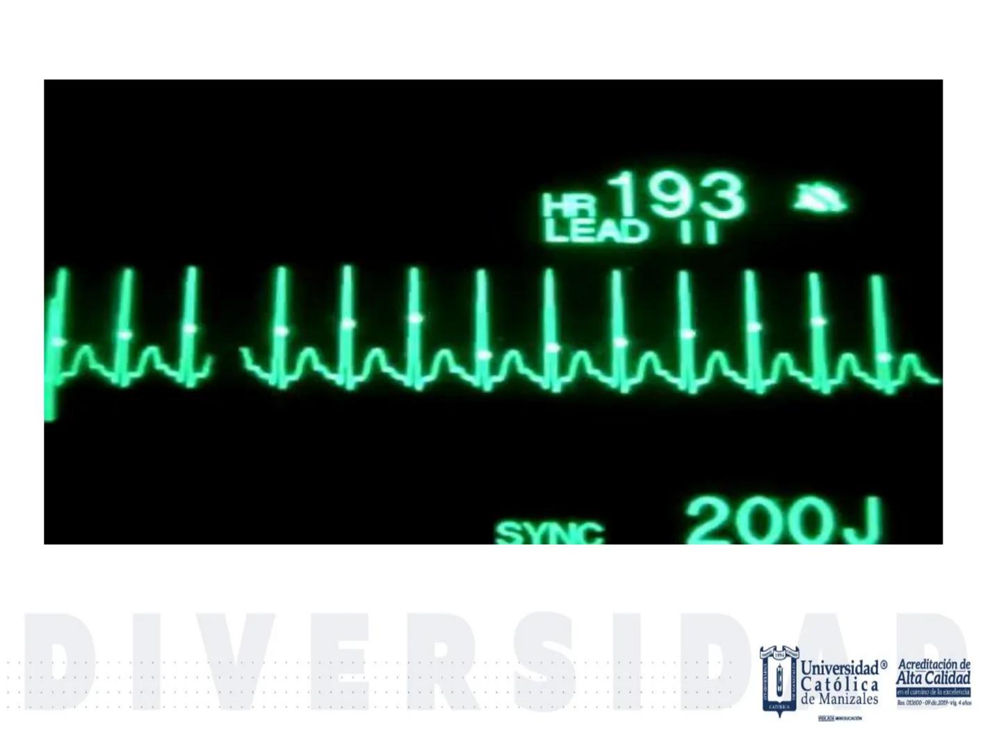 UCM
DAD 1954
UNIVERSIDAD
CARIDAD
CATOLICA
UniversidadⓇ
Católica
de Manizales
VIGILADA MINEDUCACIÓN
Acreditación de
Alta Calidad
en el camino