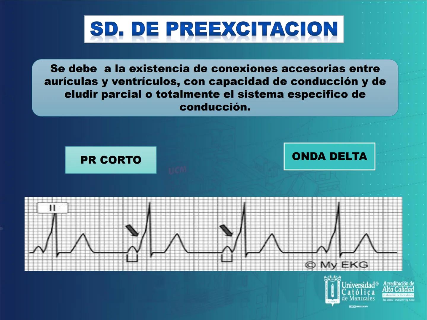 UCM
DAD 1954
UNIVERSIDAD
CARIDAD
CATOLICA
UniversidadⓇ
Católica
de Manizales
VIGILADA MINEDUCACIÓN
Acreditación de
Alta Calidad
en el camino
