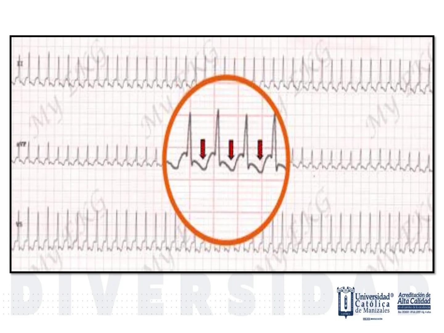 UCM
DAD 1954
UNIVERSIDAD
CARIDAD
CATOLICA
UniversidadⓇ
Católica
de Manizales
VIGILADA MINEDUCACIÓN
Acreditación de
Alta Calidad
en el camino