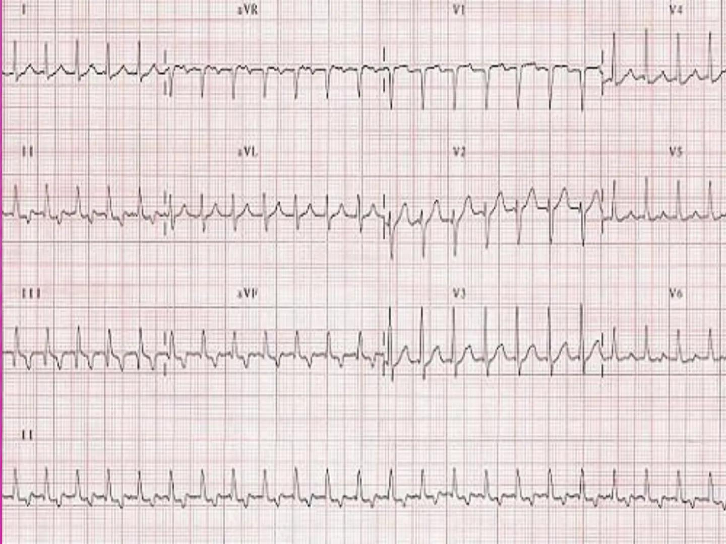 UCM
DAD 1954
UNIVERSIDAD
CARIDAD
CATOLICA
UniversidadⓇ
Católica
de Manizales
VIGILADA MINEDUCACIÓN
Acreditación de
Alta Calidad
en el camino