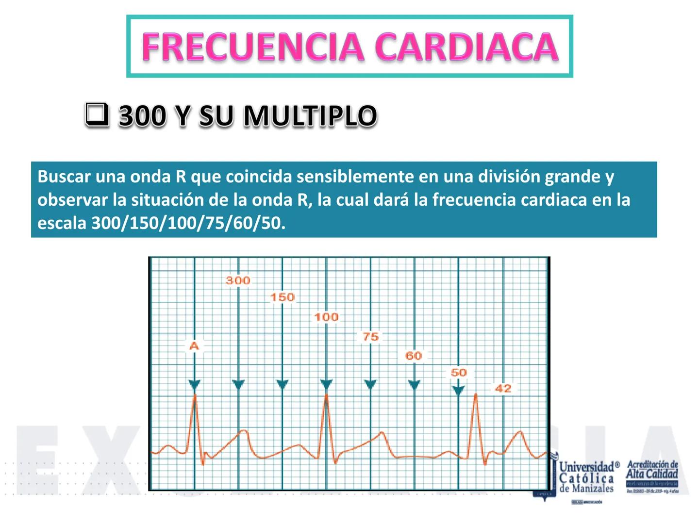UCM
DAD 1954
UNIVERSIDAD
CARIDAD
CATOLICA
UniversidadⓇ
Católica
de Manizales
VIGILADA MINEDUCACIÓN
Acreditación de
Alta Calidad
en el camino