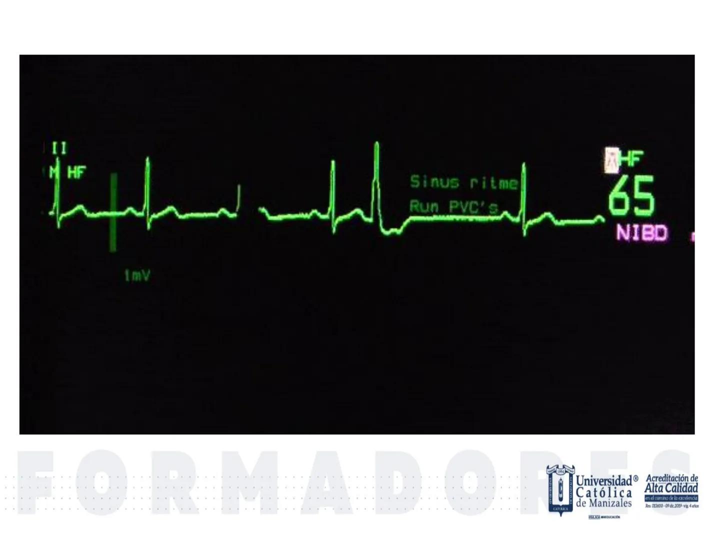 UCM
DAD 1954
UNIVERSIDAD
CARIDAD
CATOLICA
UniversidadⓇ
Católica
de Manizales
VIGILADA MINEDUCACIÓN
Acreditación de
Alta Calidad
en el camino