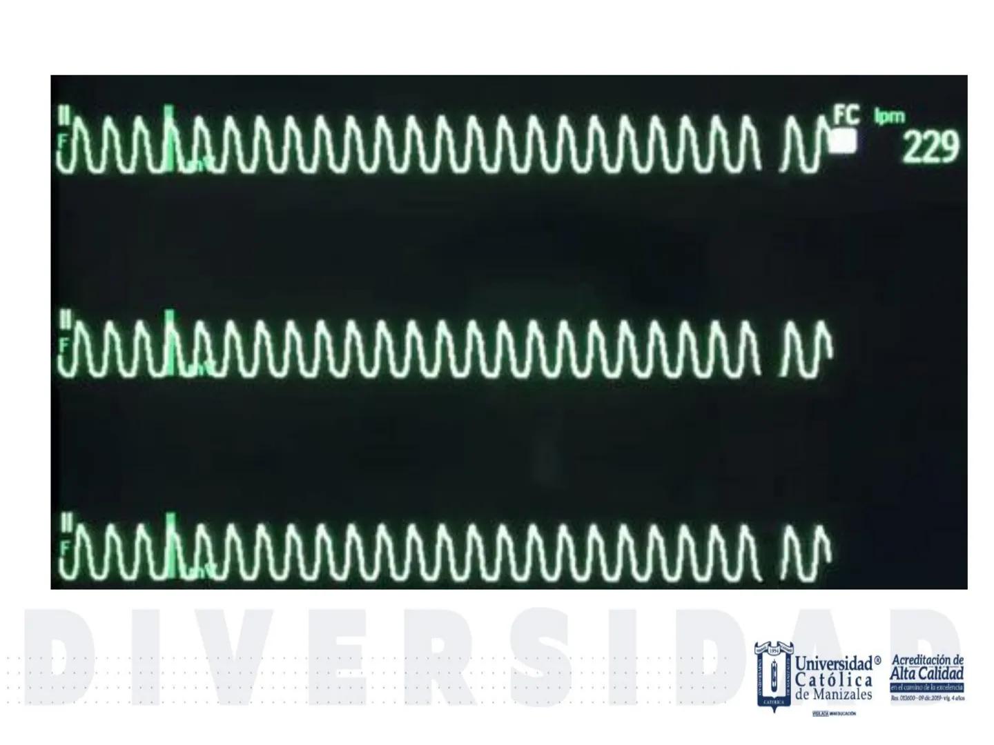 UCM
DAD 1954
UNIVERSIDAD
CARIDAD
CATOLICA
UniversidadⓇ
Católica
de Manizales
VIGILADA MINEDUCACIÓN
Acreditación de
Alta Calidad
en el camino