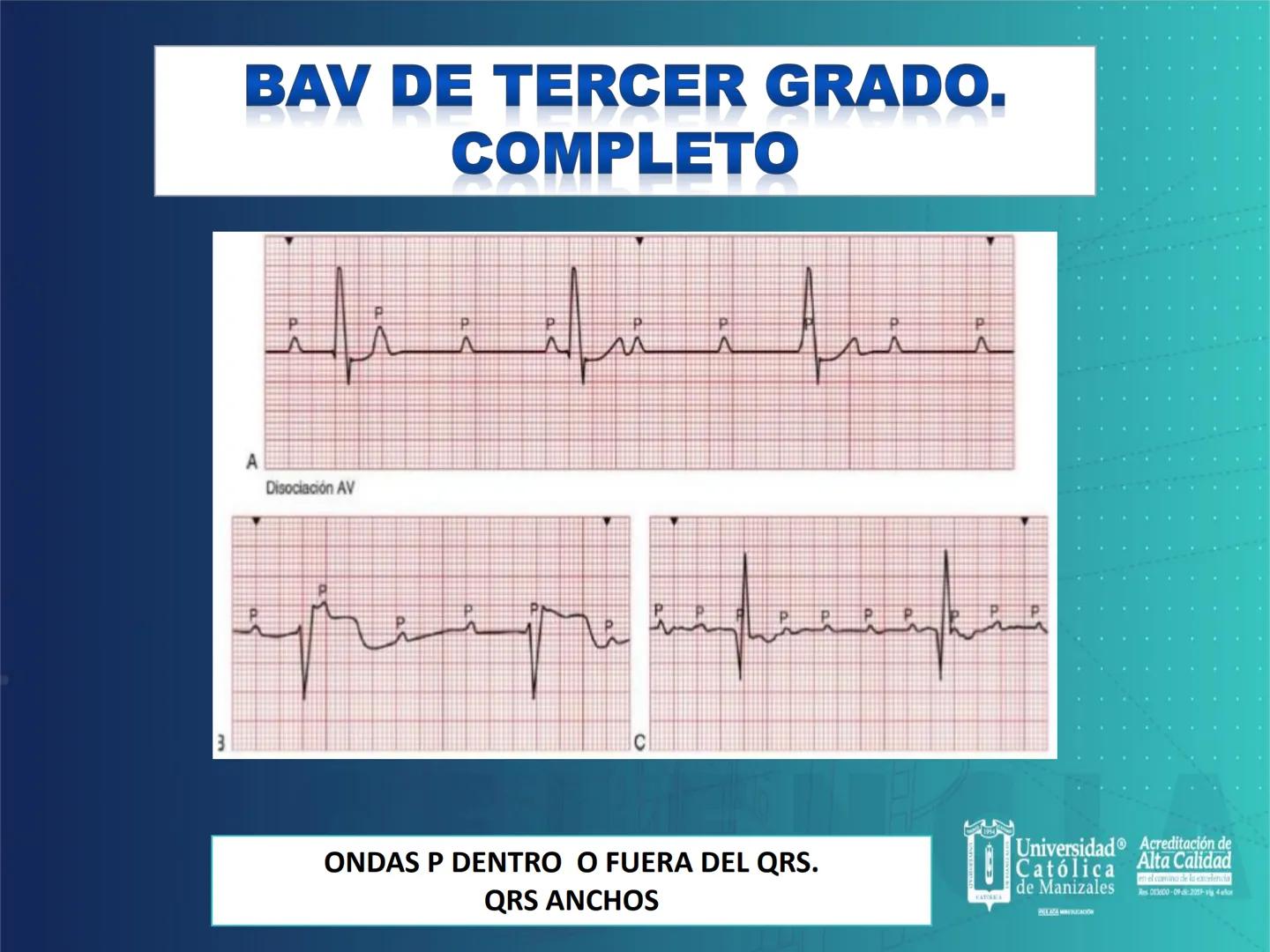 UCM
DAD 1954
UNIVERSIDAD
CARIDAD
CATOLICA
UniversidadⓇ
Católica
de Manizales
VIGILADA MINEDUCACIÓN
Acreditación de
Alta Calidad
en el camino