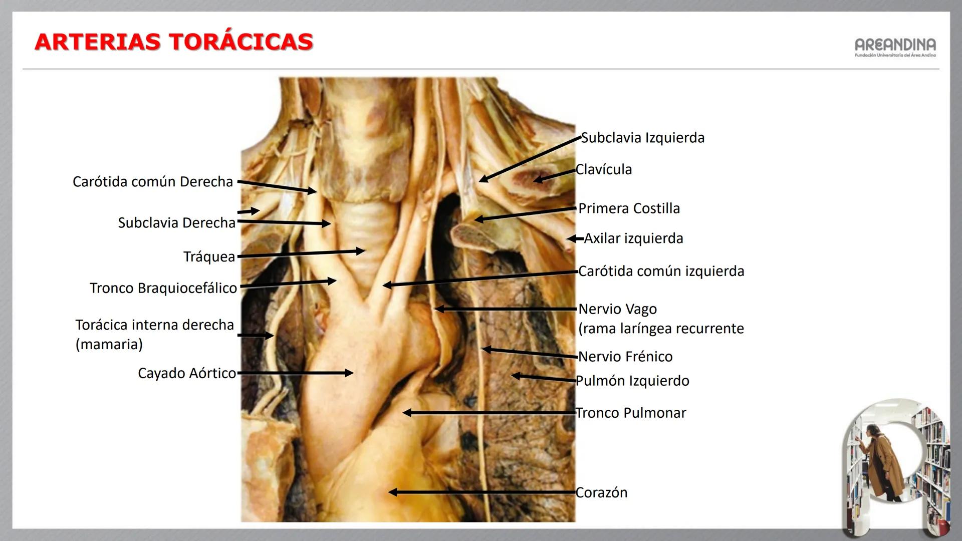 # ENFERMERÍA
# MORFOFISIOLOGÍA I
Sistema Cardiovascular
- Sistema Linfático
AREANDINA
Fundación Universitaria del Área Andina # VASOS SA