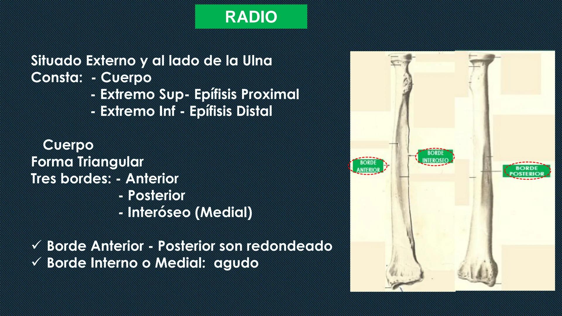 # HUESOS DEL MIEMBRO
SUPERIOR
Dr. Orsini Flores Monterrey
Medico-Cirujano
Ortopedista- Traumatólogo
UCN
Universided Central de Nicaragua