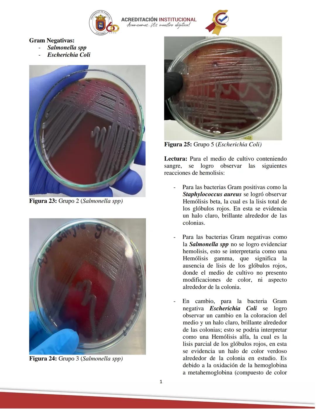ACREDITACIÓN INSTITUCIONAL
Avanzamos... ¡Es nuestro objetivo!
Universidad De Pamplona
Facultad de Ciencias Agrarias
Departamento de Medicin