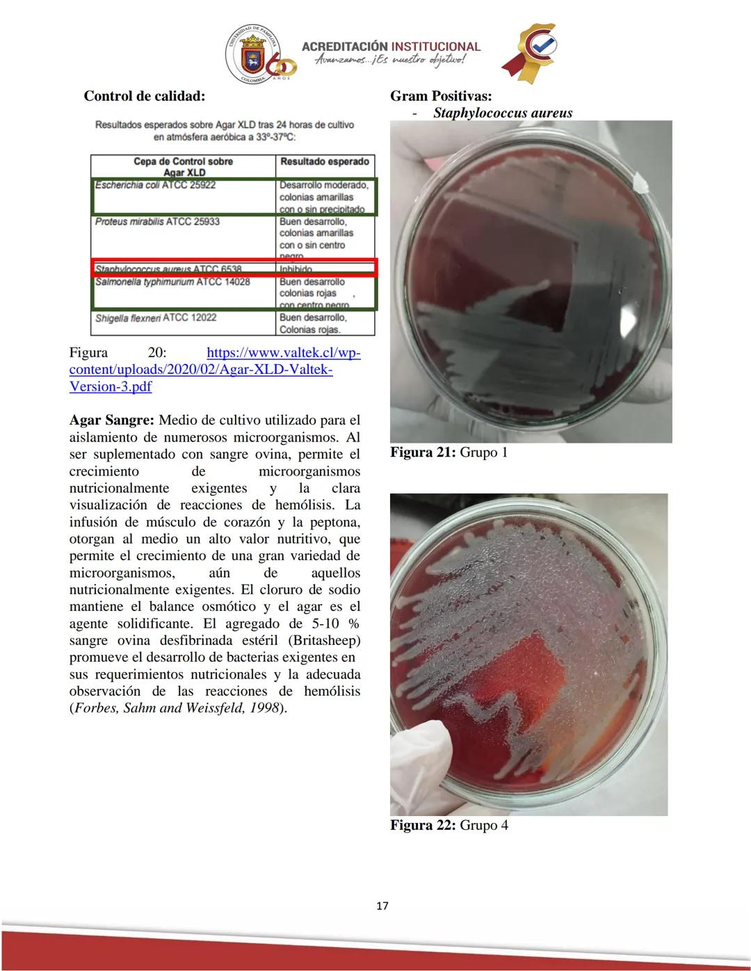 ACREDITACIÓN INSTITUCIONAL
Avanzamos... ¡Es nuestro objetivo!
Universidad De Pamplona
Facultad de Ciencias Agrarias
Departamento de Medicin