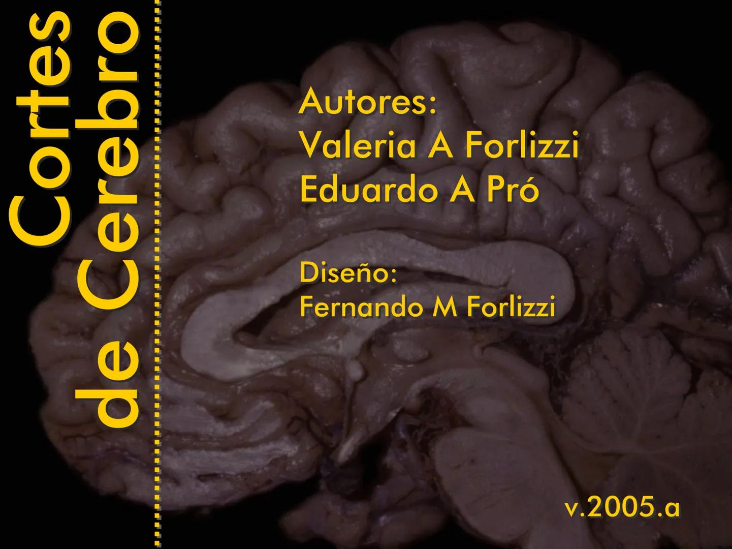 Cortes
de Cerebro
Autores:
Valeria A Forlizzi
Eduardo A Pró
Diseño:
Fernando M Forlizzi
ν.2005.α # Corte sagital medio de encéfalo # Partes