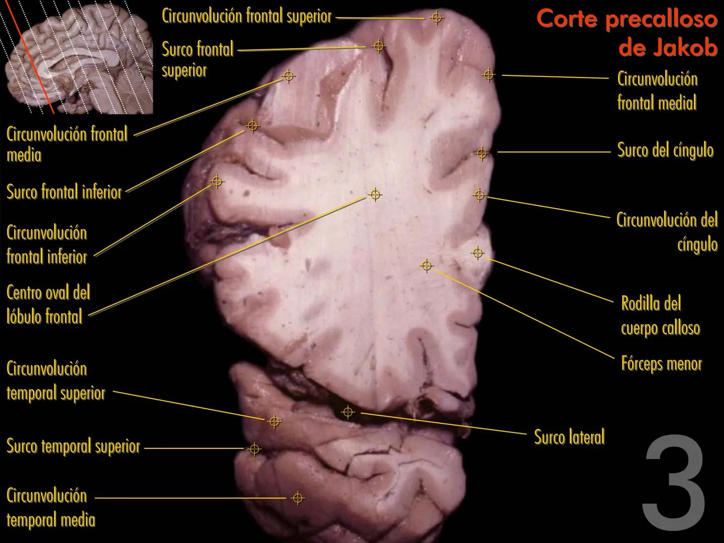 Cortes
de Cerebro
Autores:
Valeria A Forlizzi
Eduardo A Pró
Diseño:
Fernando M Forlizzi
ν.2005.α # Corte sagital medio de encéfalo # Partes
