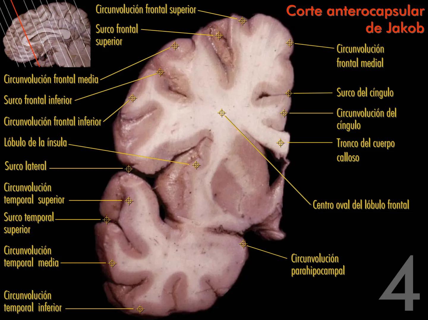 Cortes
de Cerebro
Autores:
Valeria A Forlizzi
Eduardo A Pró
Diseño:
Fernando M Forlizzi
ν.2005.α # Corte sagital medio de encéfalo # Partes