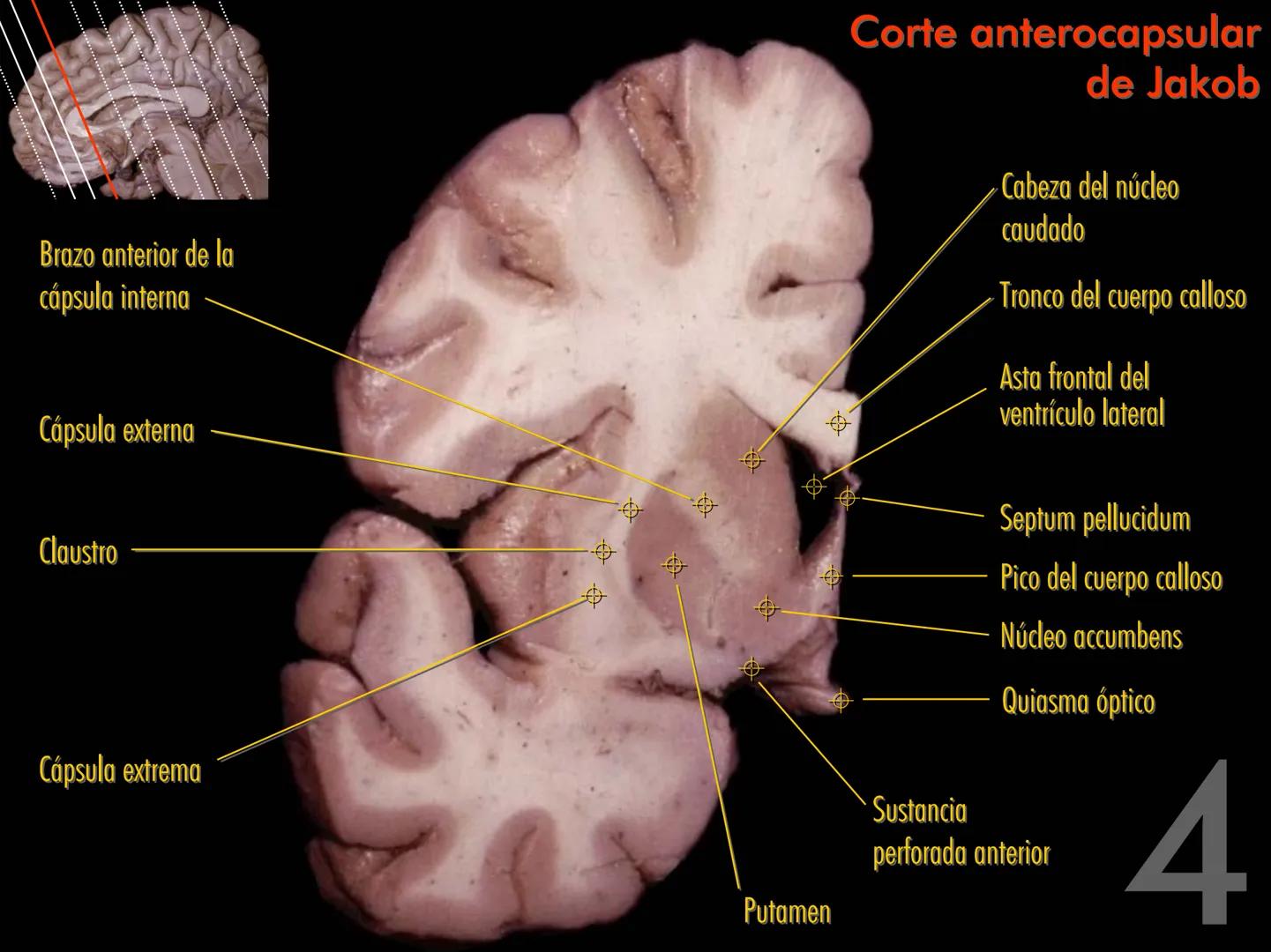 Cortes
de Cerebro
Autores:
Valeria A Forlizzi
Eduardo A Pró
Diseño:
Fernando M Forlizzi
ν.2005.α # Corte sagital medio de encéfalo # Partes