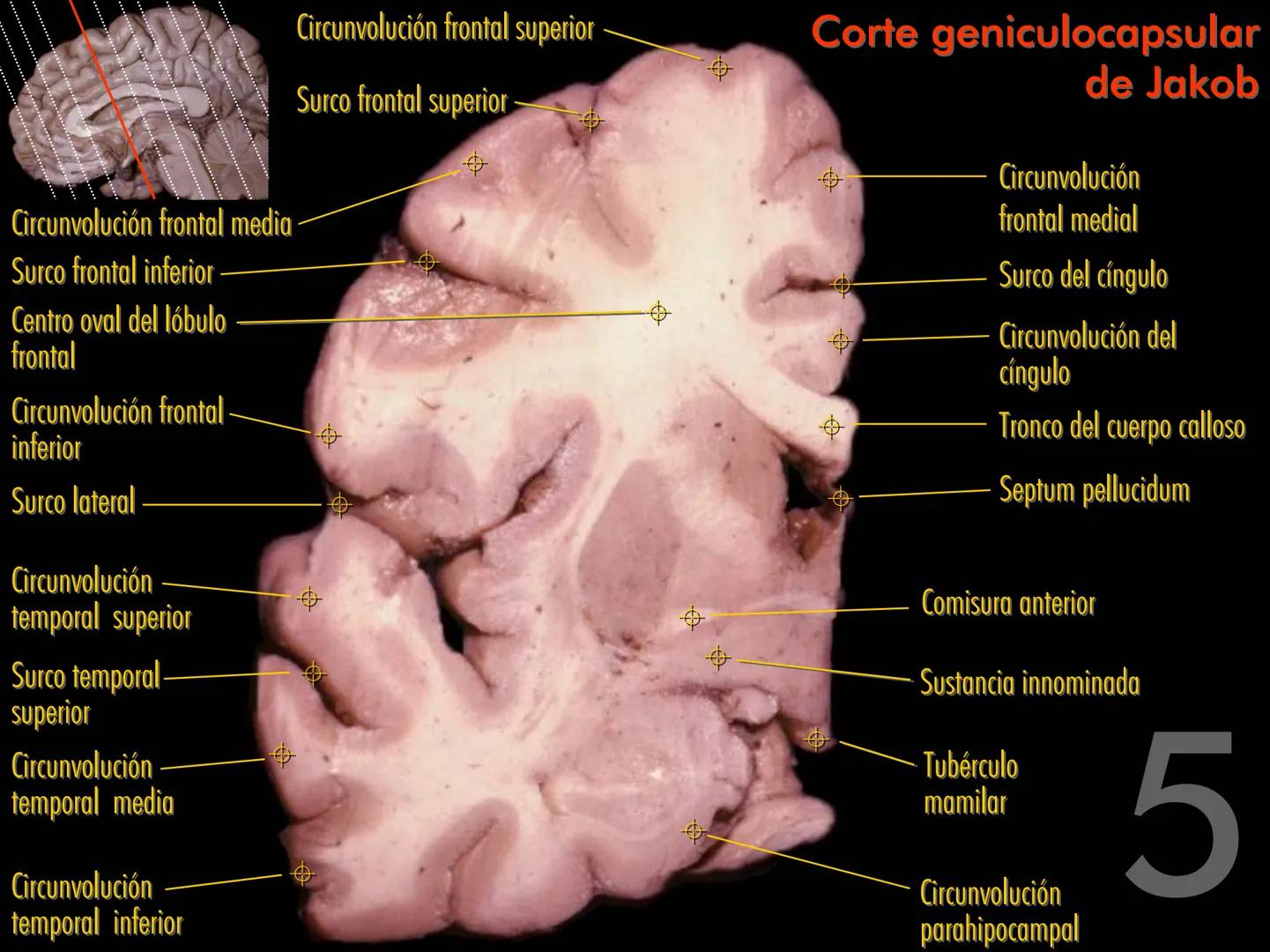 Cortes
de Cerebro
Autores:
Valeria A Forlizzi
Eduardo A Pró
Diseño:
Fernando M Forlizzi
ν.2005.α # Corte sagital medio de encéfalo # Partes