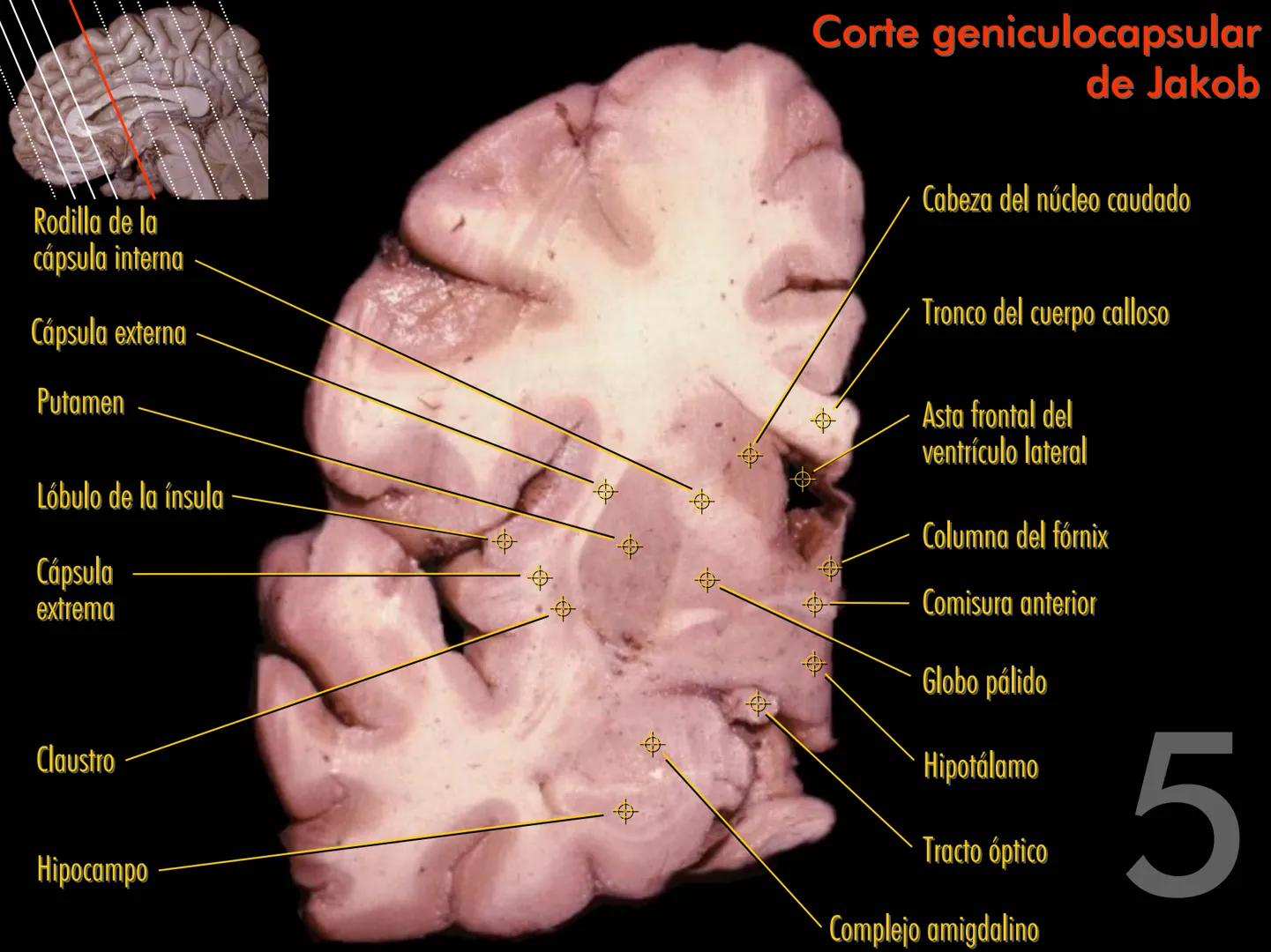Cortes
de Cerebro
Autores:
Valeria A Forlizzi
Eduardo A Pró
Diseño:
Fernando M Forlizzi
ν.2005.α # Corte sagital medio de encéfalo # Partes