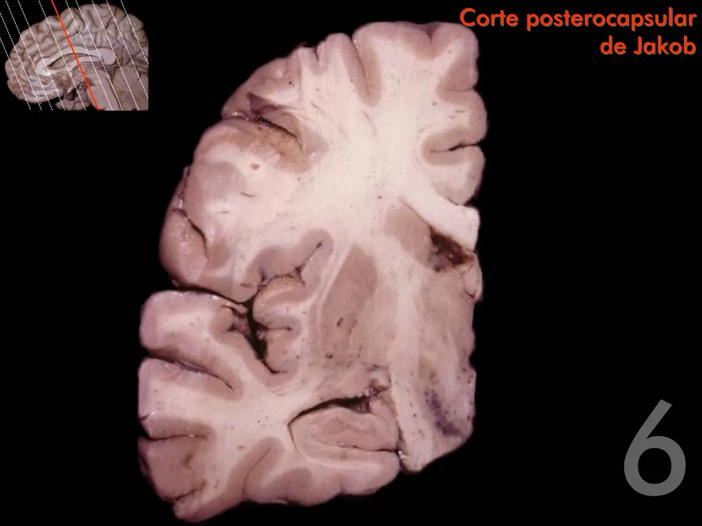 Cortes
de Cerebro
Autores:
Valeria A Forlizzi
Eduardo A Pró
Diseño:
Fernando M Forlizzi
ν.2005.α # Corte sagital medio de encéfalo # Partes