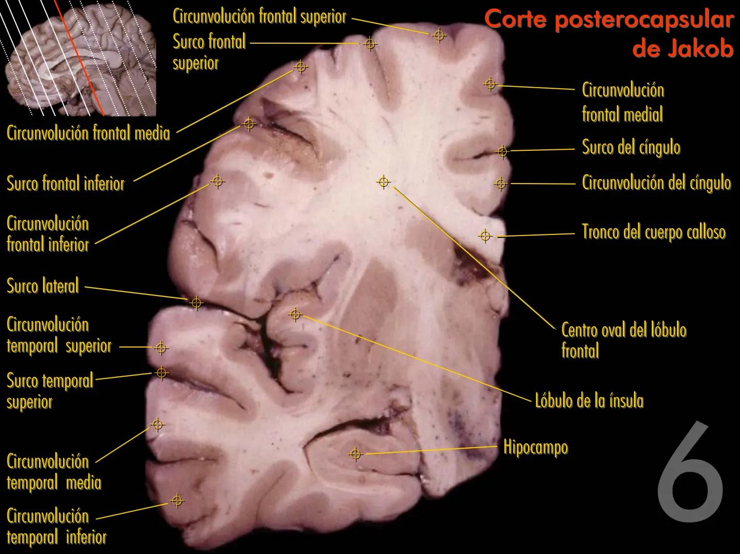 Cortes
de Cerebro
Autores:
Valeria A Forlizzi
Eduardo A Pró
Diseño:
Fernando M Forlizzi
ν.2005.α # Corte sagital medio de encéfalo # Partes